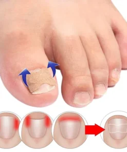 Фластери за враснати нокти